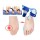 ���������� ���� (������ ������) HavSplint ����, ���������
